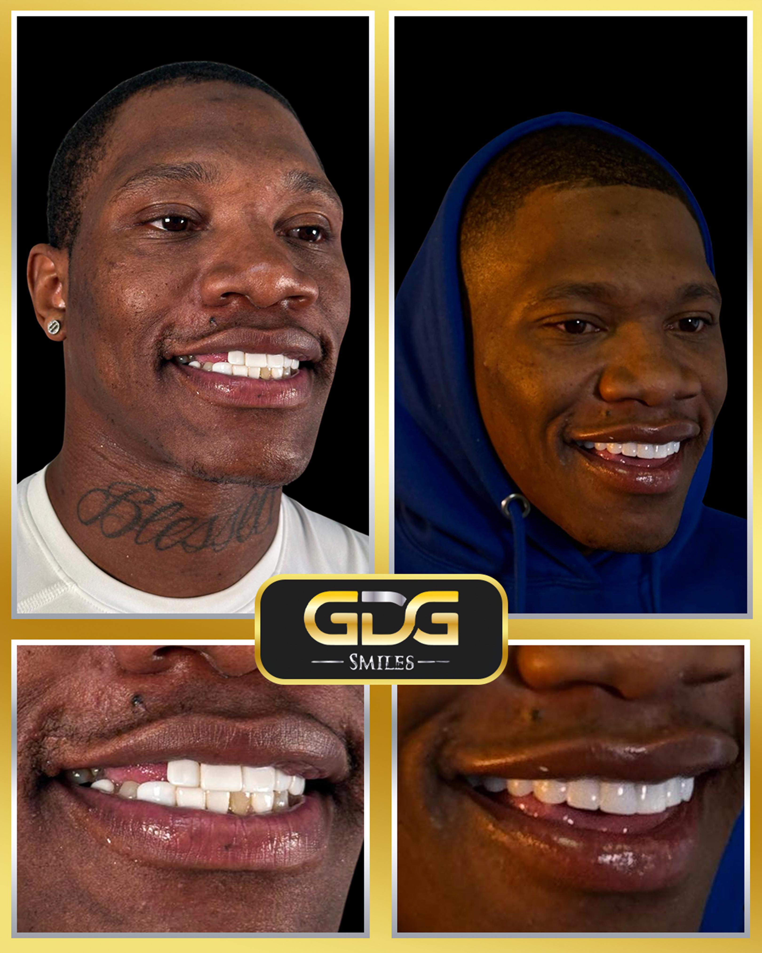 GDG Smiles