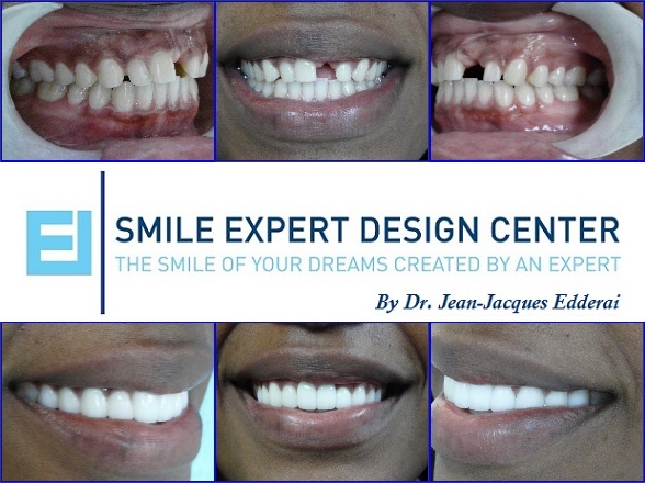 SMILE EXPERT DESIGN CENTER by Dr. Jean-Jacques Edderai Photo