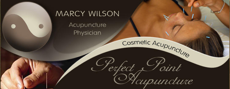 Marcy Wilson Acupuncture Photo