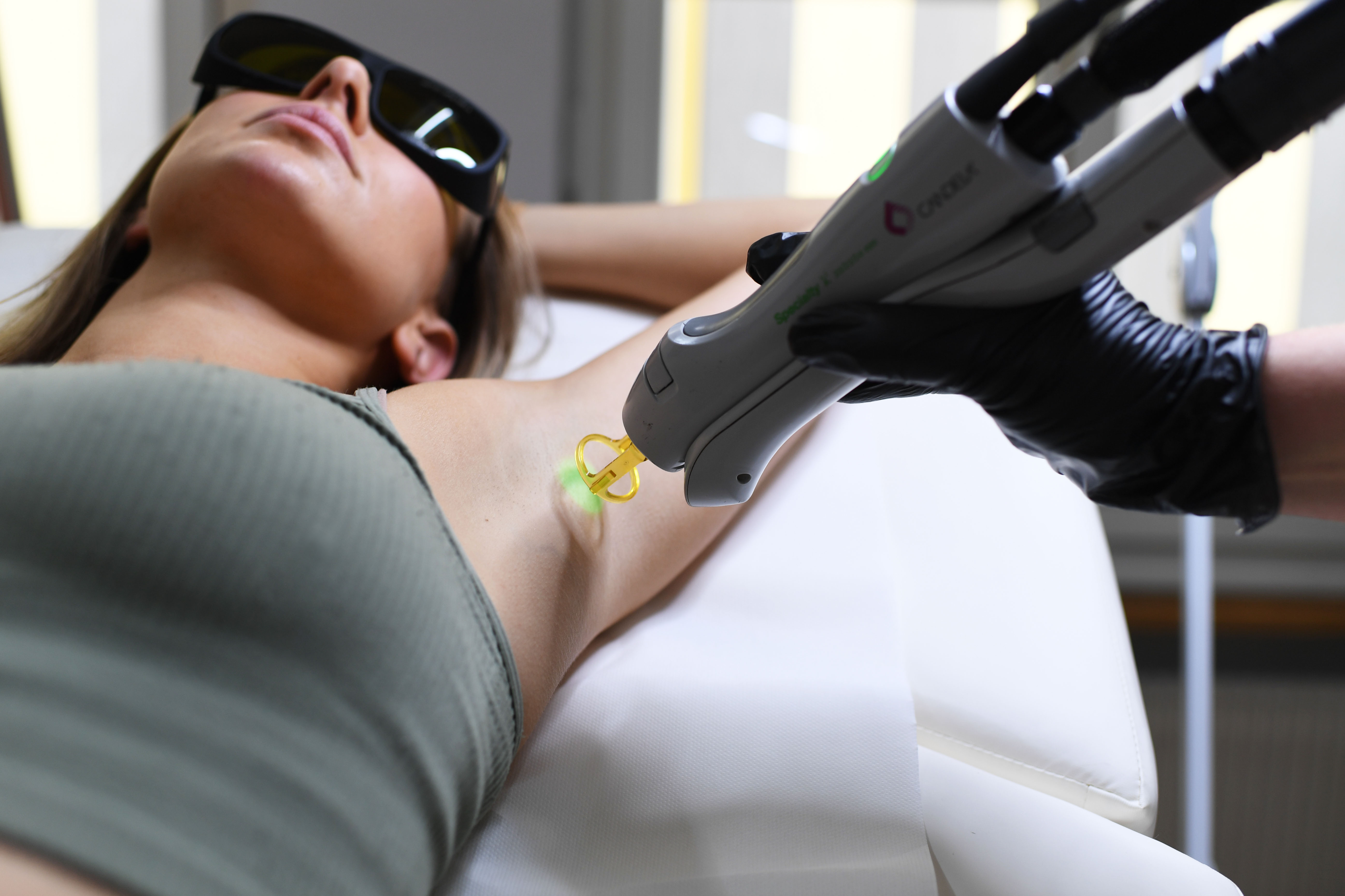 Laser hair removal Bern – Alexandrite laser