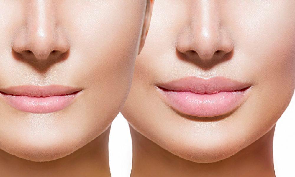 Laser Touch Medical Clinic is specialized in making you look beautiful. Through our specialized techniques, top of the line products and staying on top of the newest trends, we ensure a beautiful and natural looking you. Call today to schedule a consultation.