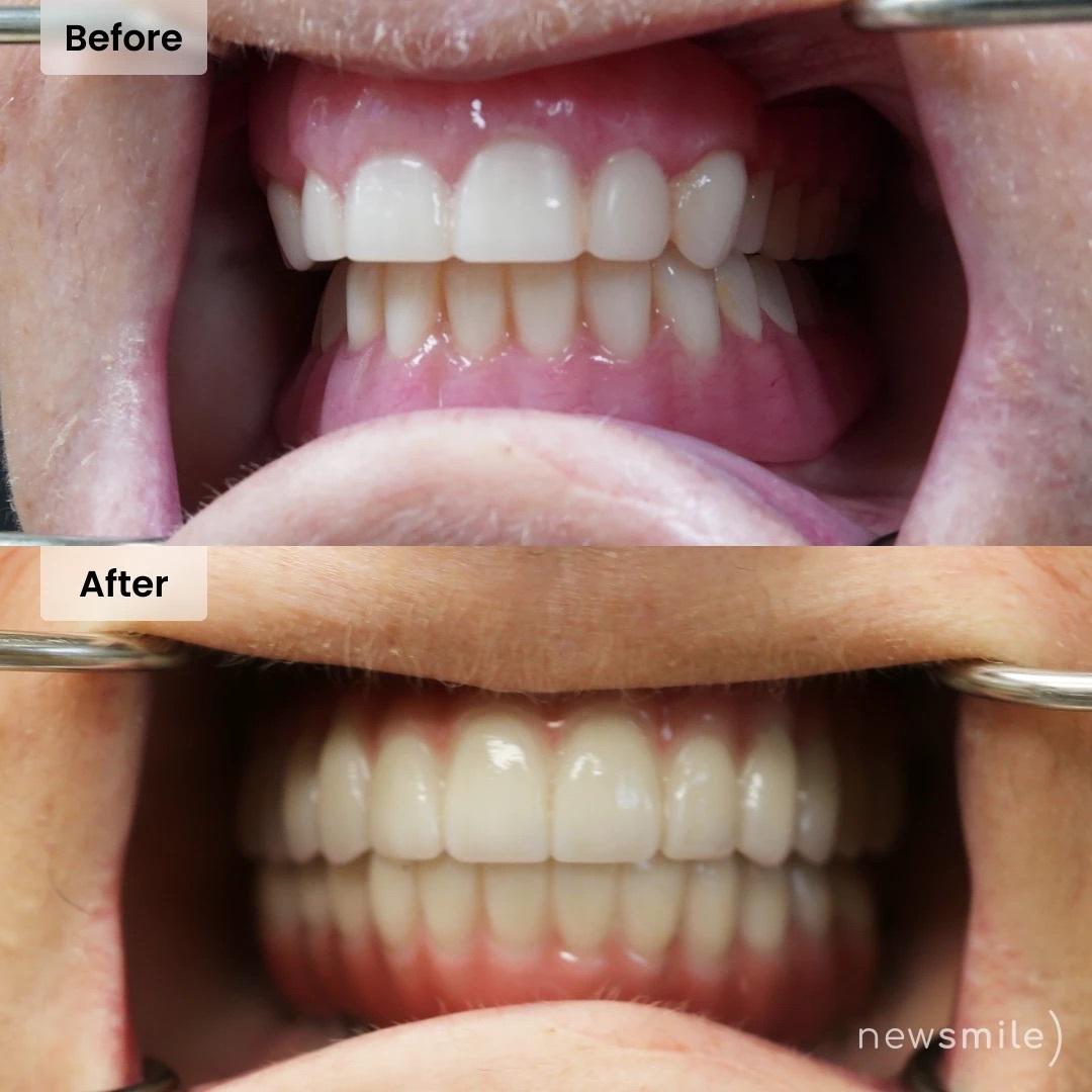 New Smile Columbus Dental Implant Studio Image