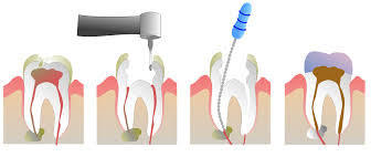 Ryan Frederickson DDS Pllc Family Dentistry & Denture Center Photo