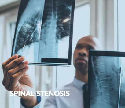 Spinal Stenosis