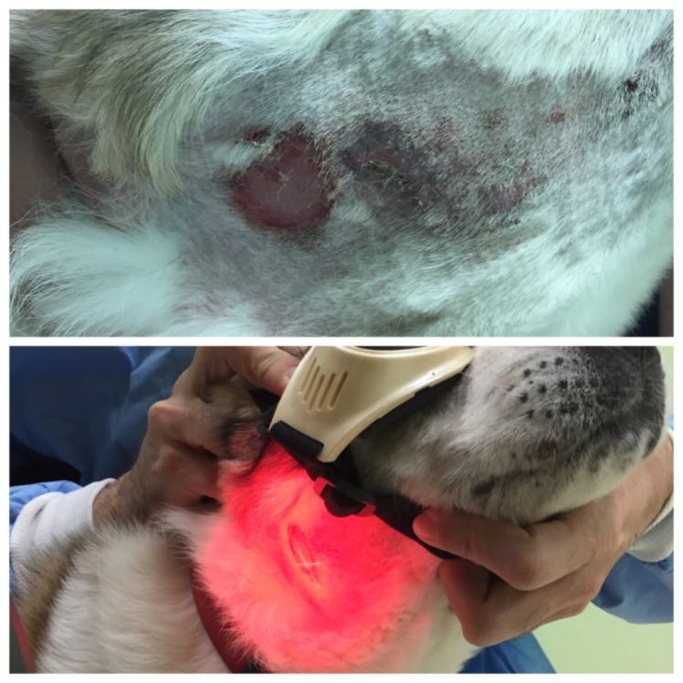 MLS Laser treatment for a Hot spot.