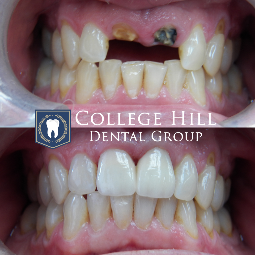 College Hill Dental Group Photo