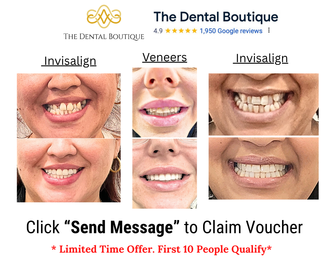 50% off Smile Makeovers 
