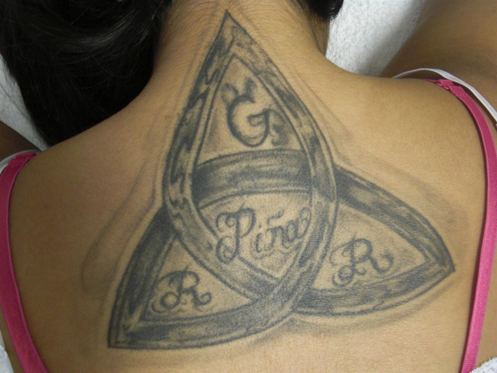 medermis laser tattoo removal san antonio tx business medermis laser tattoo removal san antonio tx business
