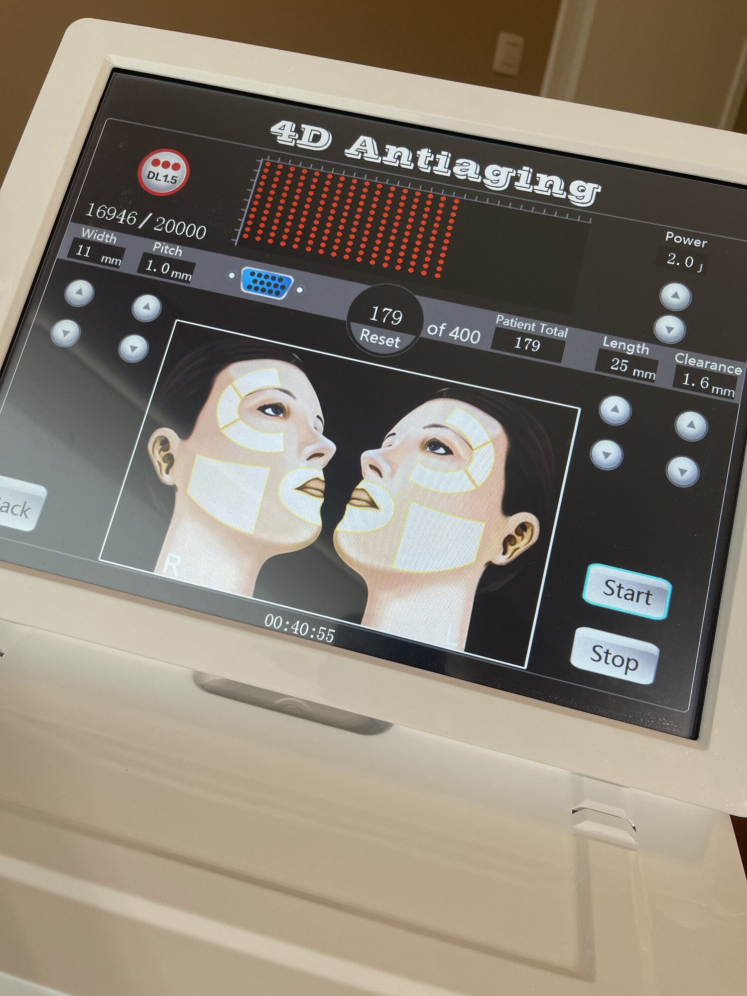 Miniature de la galerie