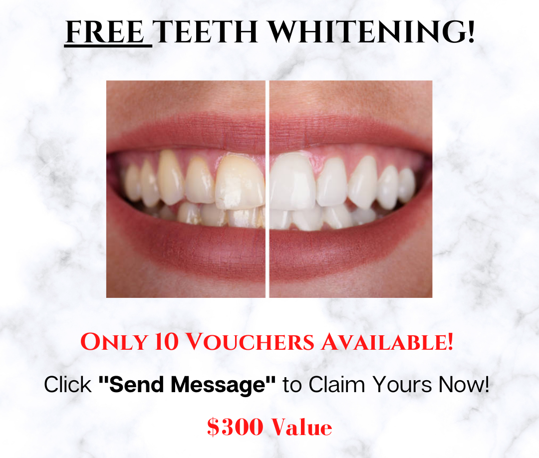 FREE Teeth Whitening 