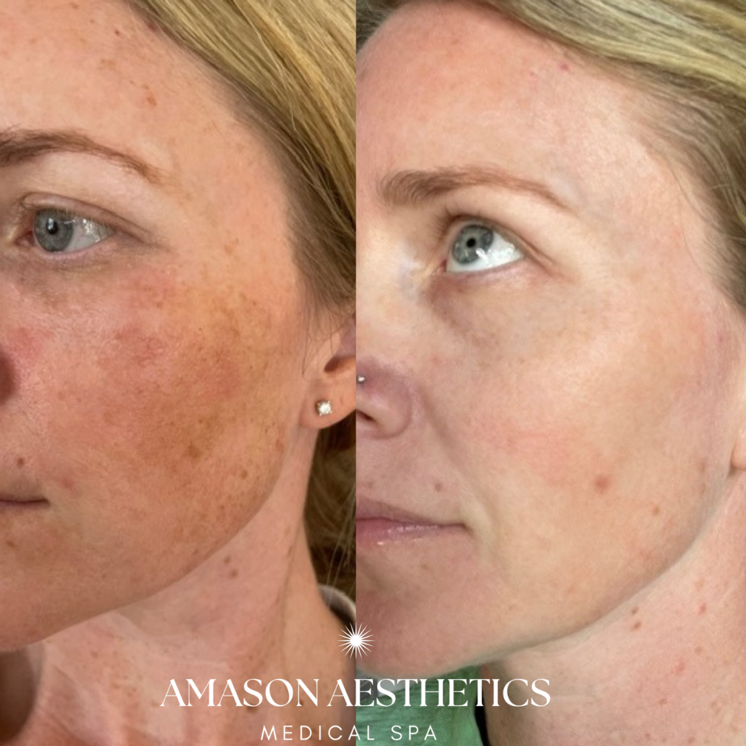 Amason Aesthetics - World Golf Village Image