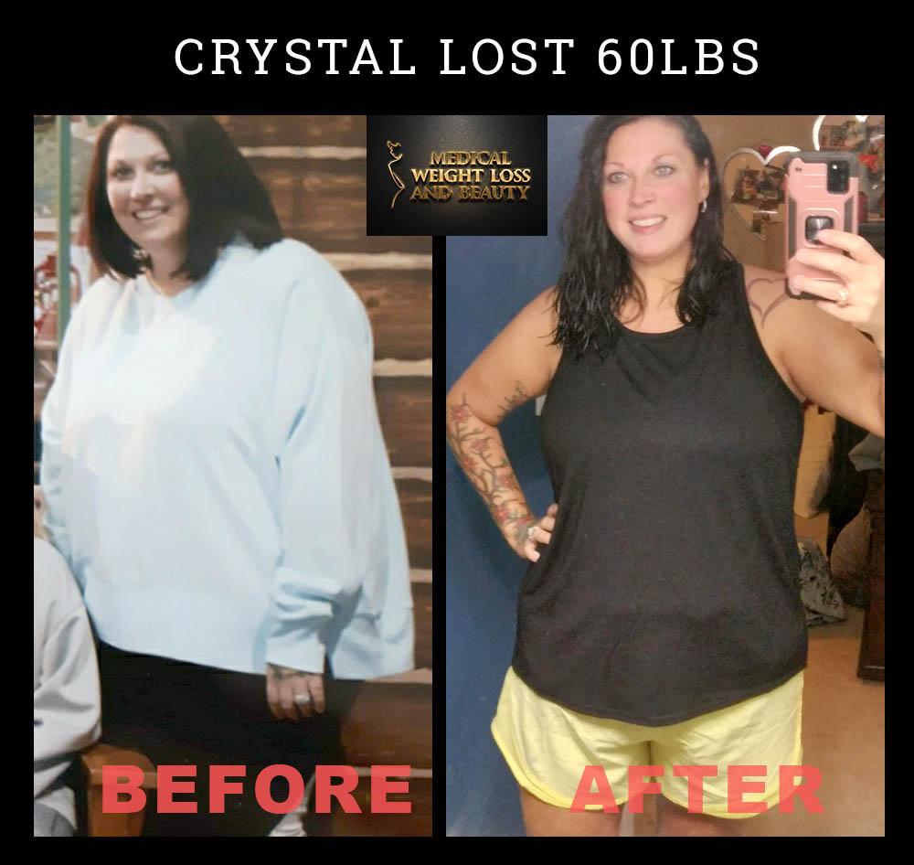 Medical Weight Loss and Beauty Image