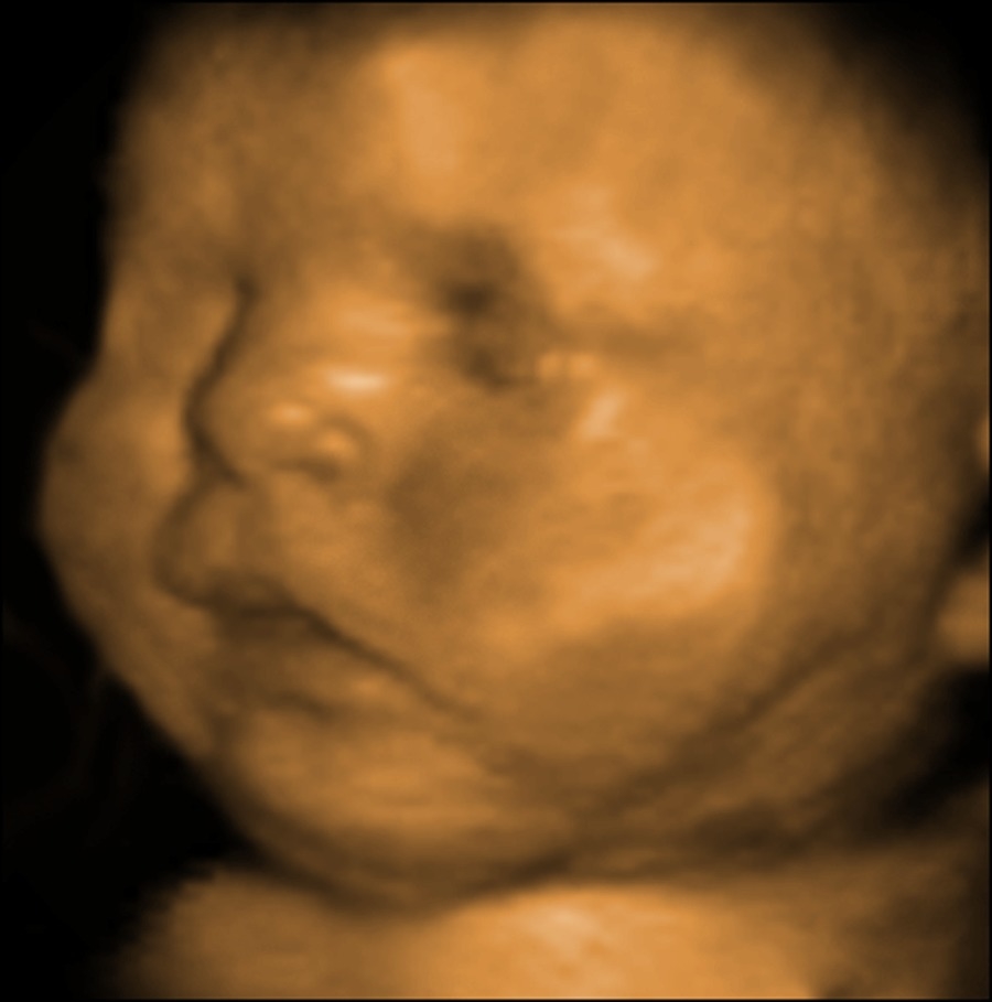 4d fetal ultrasound