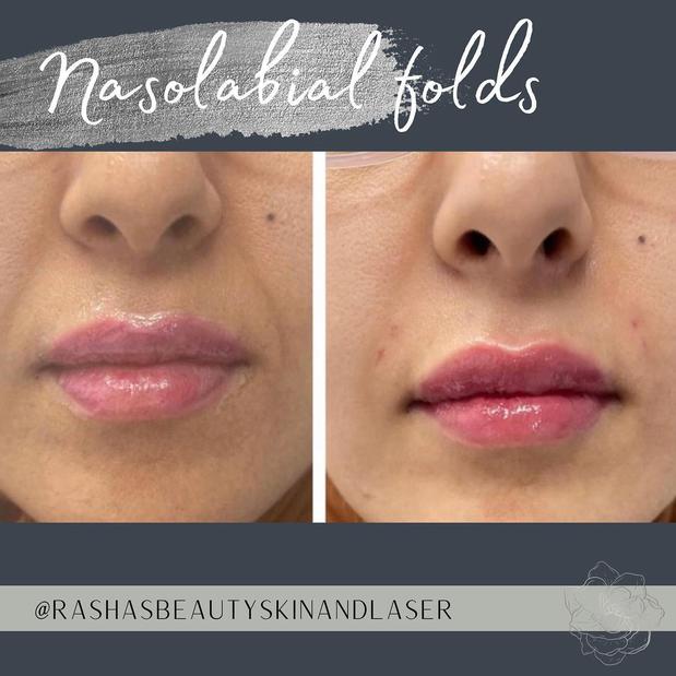 Images Rasha's Beauty Skin & Laser
