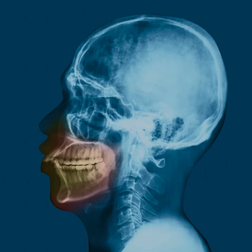 Oral and Facial Trauma