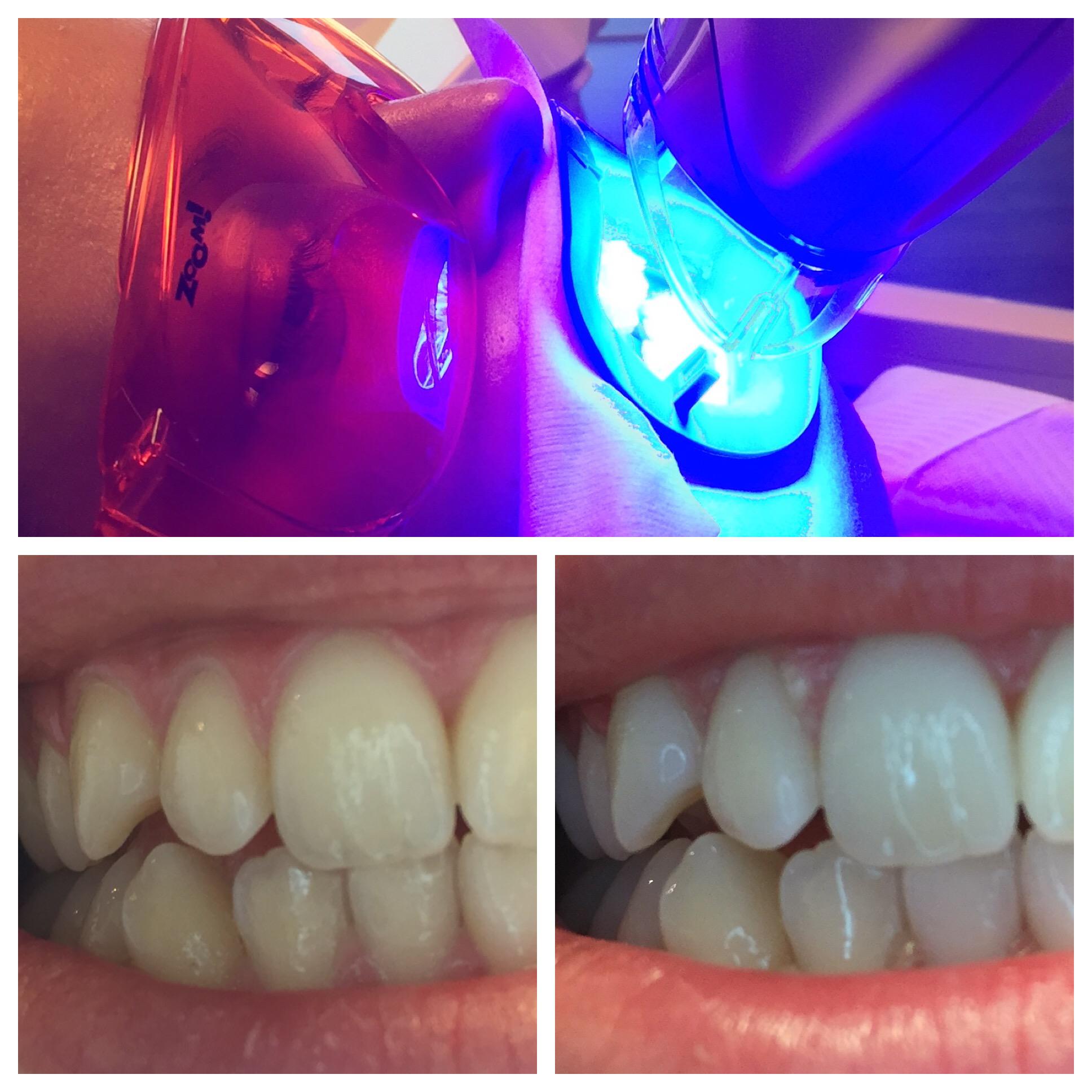 Dentalhygiene Tschan Claudia