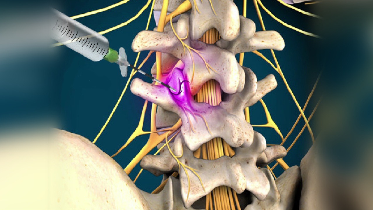 Regenerative Spine & Joint Center Photo
