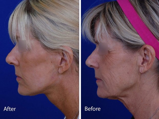 Images Visage Facial Plastic Surgery