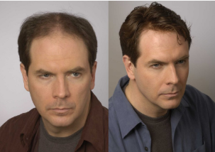 Images Advanced Hair Alternatives