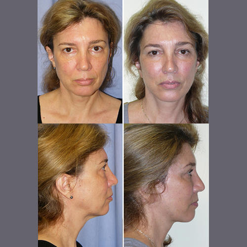 Images The Brandow Clinic Plastic Surgery - Kirk Brandow, MD
