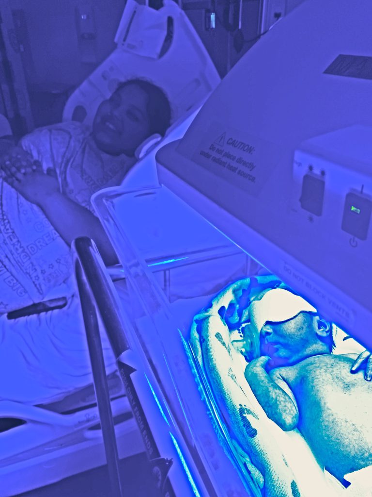 New mother with baby under bili light