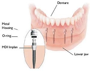 Advana Dental & Dentures Photo