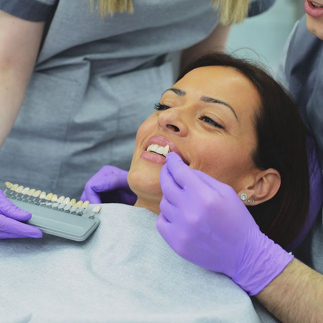 Veneers