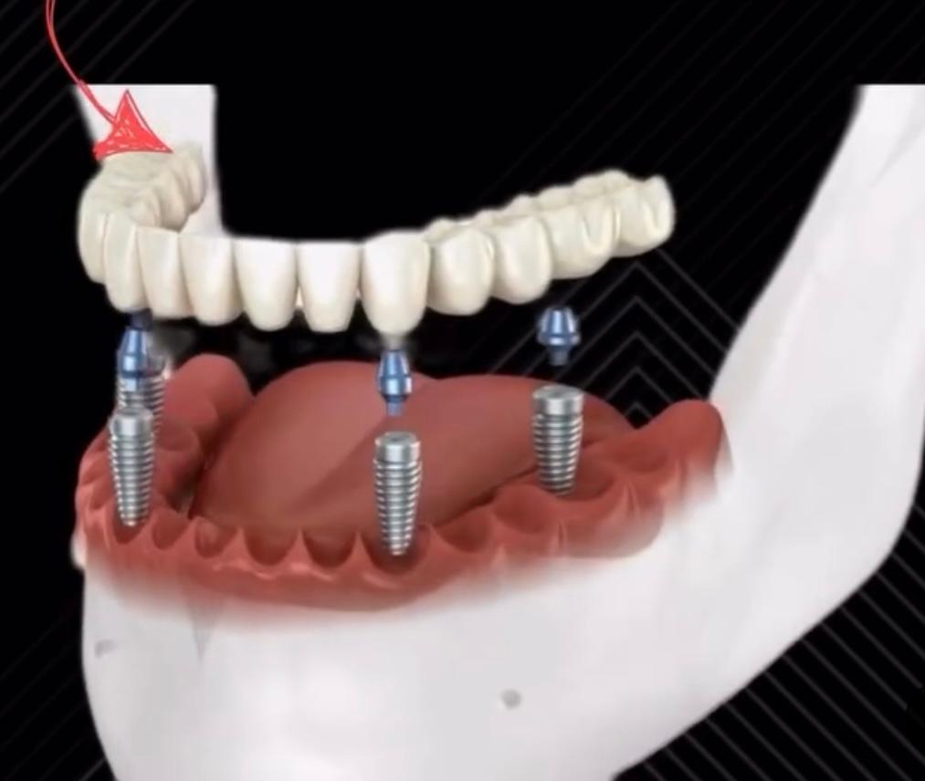 Premier Oral Facial & Implant Surgery Image