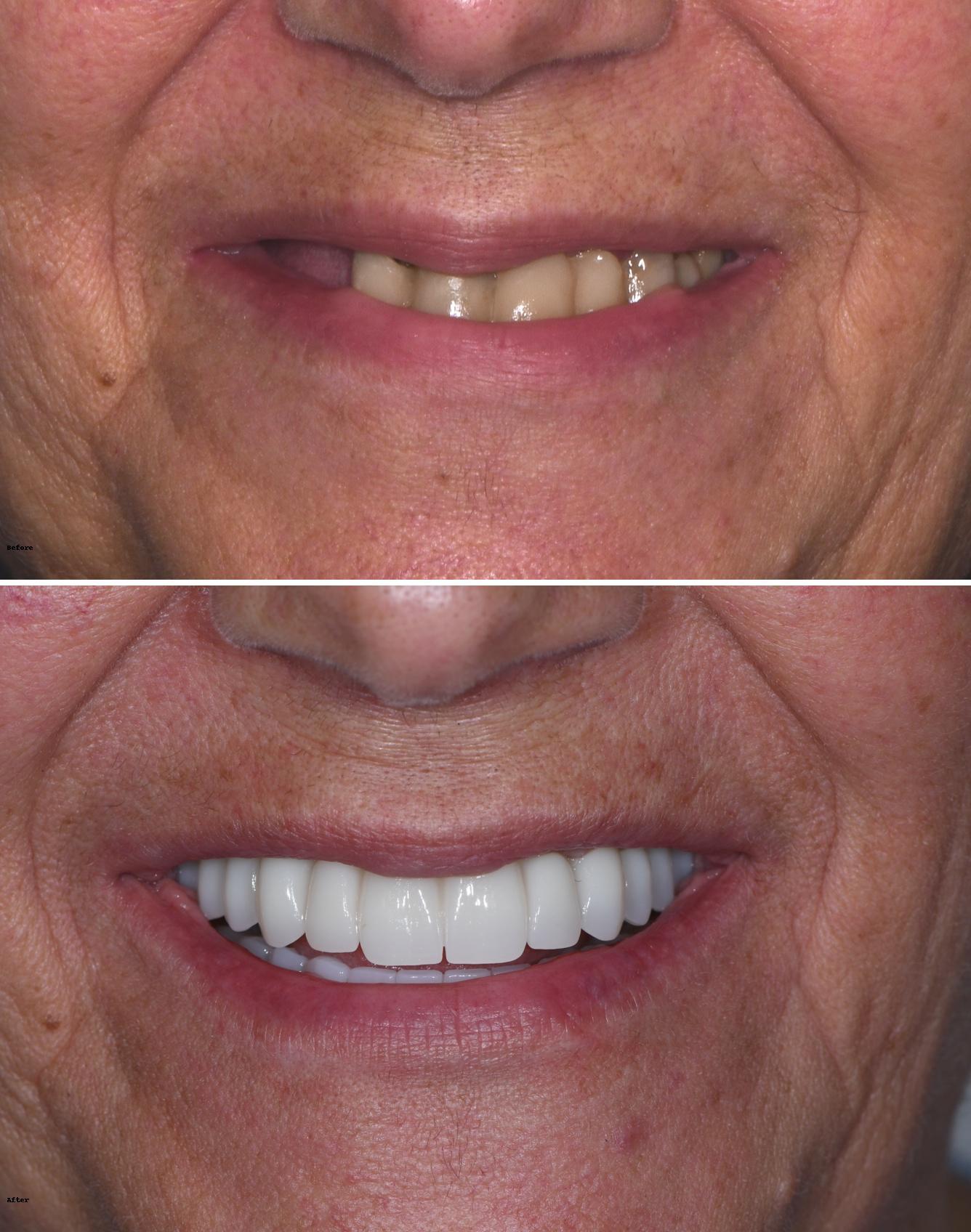 Empower Dental Pasadena Image