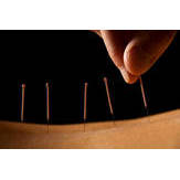 Classical Acupuncture & Herbs