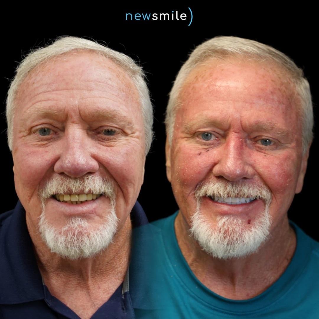 New Smile Columbus Dental Implant Studio Image