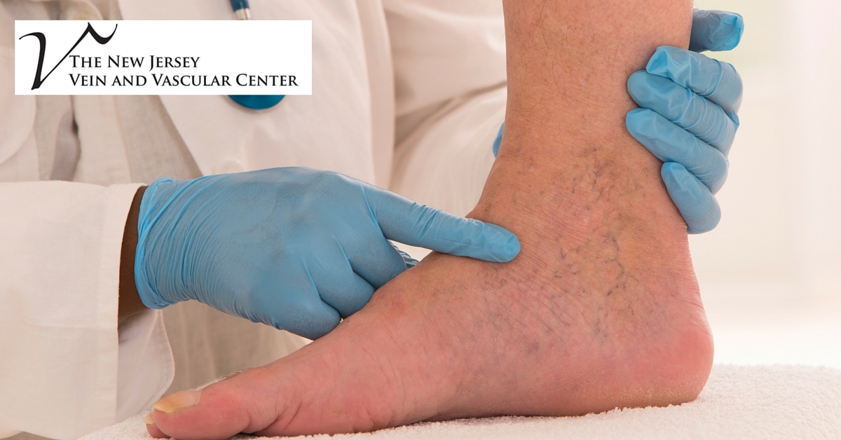 The New Jersey Vein & Vascular Center Photo