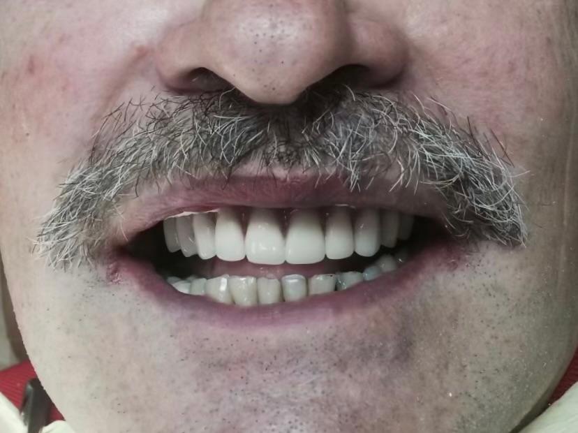 Premier Oral Facial & Implant Surgery Image