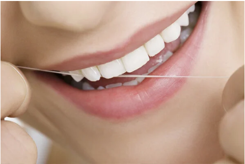 Igiene dentale profilassi