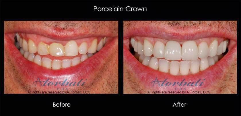Arman Torbati, DDS, FACP