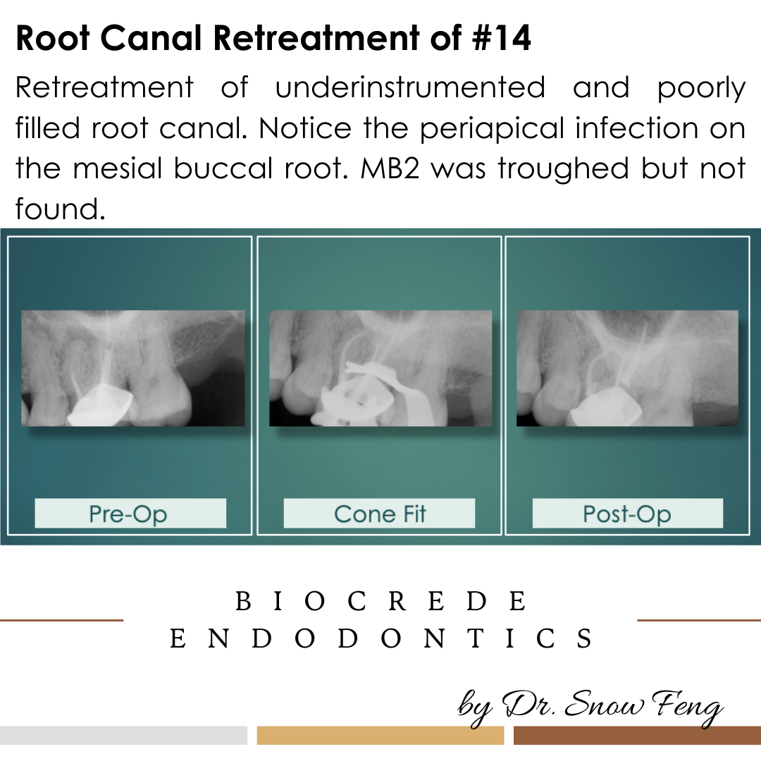 Biocrede Endodontics Image