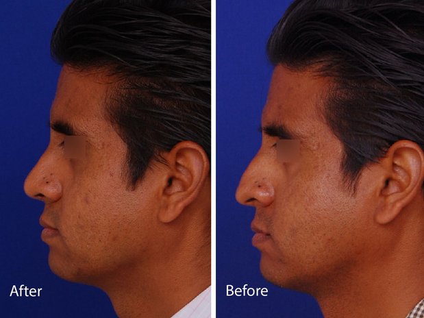 Images Visage Facial Plastic Surgery
