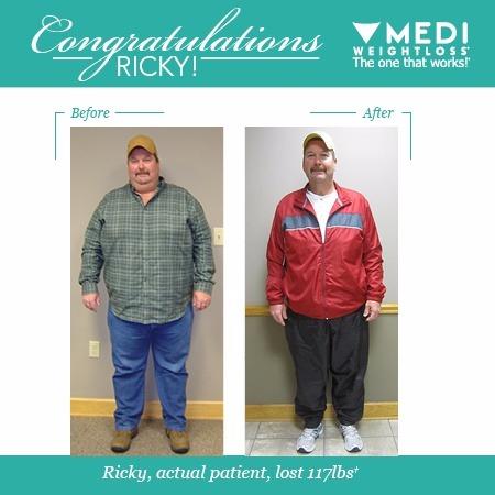 Medi-Weightloss
