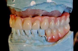 McCall Dentures Photo