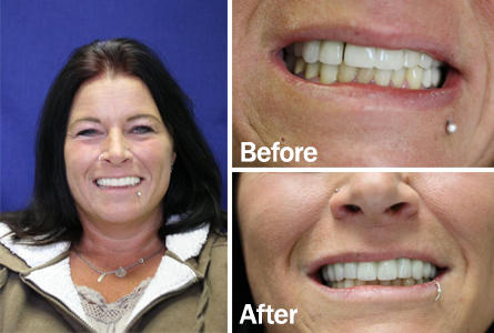 Images Uptown Cosmetic & Implant Dentistry