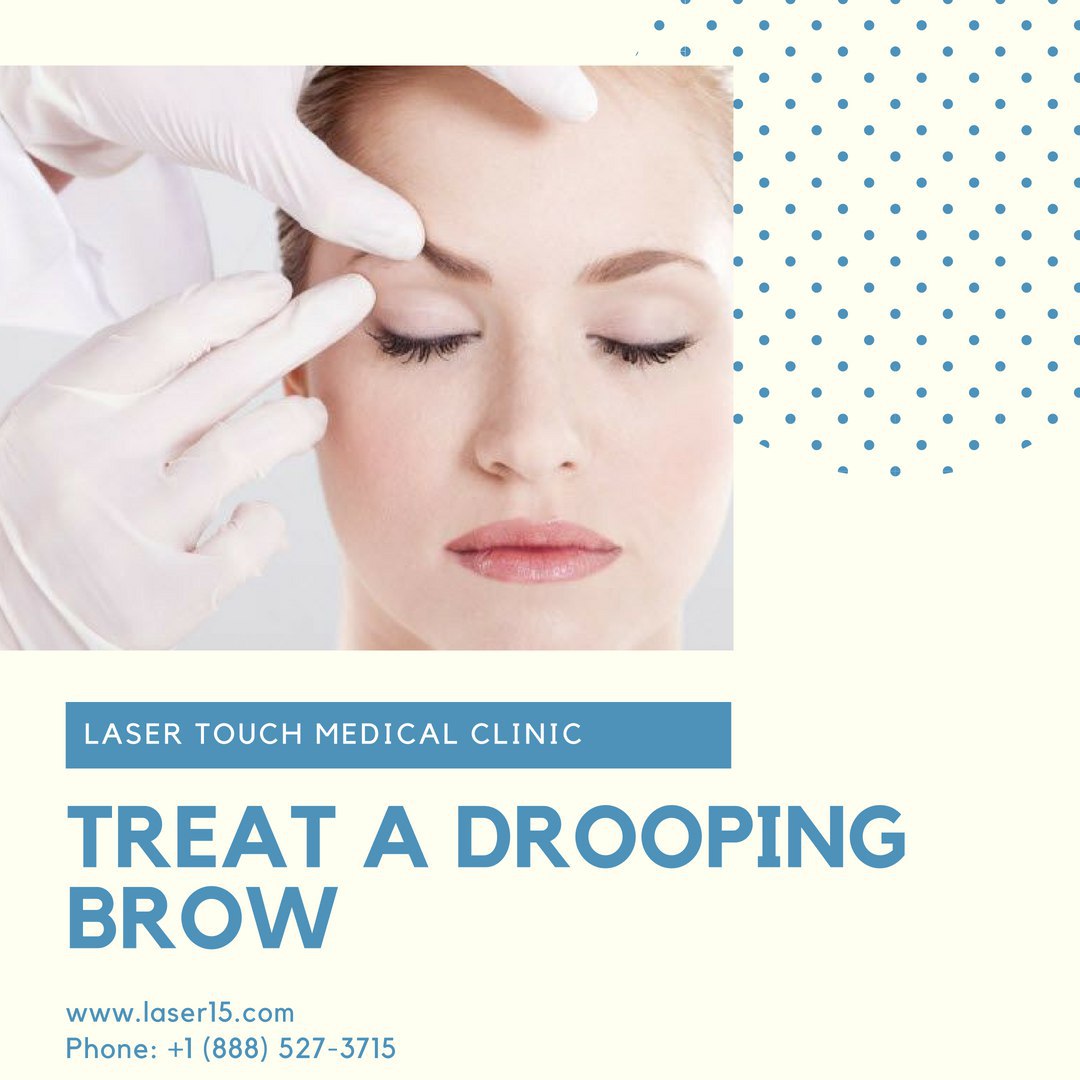 Botox Benefit  1: Treat a Drooping Brow. Also called 