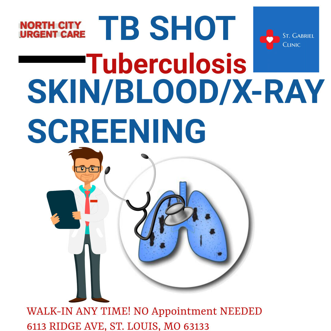 Tuberculosis screening