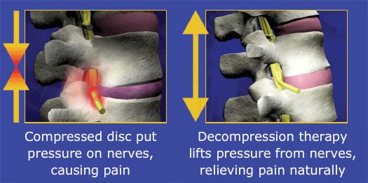 Neck Pain Back Pain and Headache Relief Center Photo