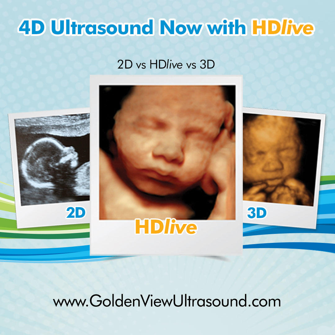 GoldenView Ultrasound Boston MA offers 3d/4d HDLive prental ultrasound services.  Providing the highest quality ultrasound images and video.