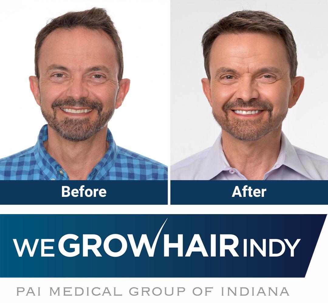 We Grow Hair Indy Photo