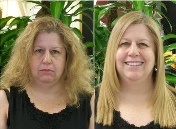 Dermaculture facial fort lauderdale fl