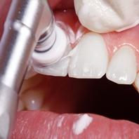 Images Gabinet Stomatologiczny Izodent-S