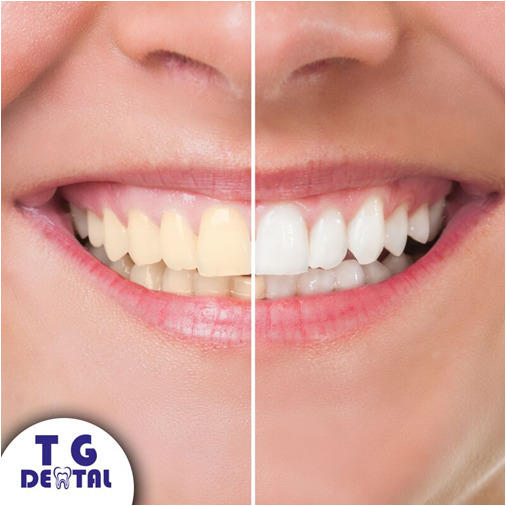 Images T.G. Dental