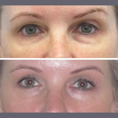 Images The Brandow Clinic Plastic Surgery - Kirk Brandow, MD