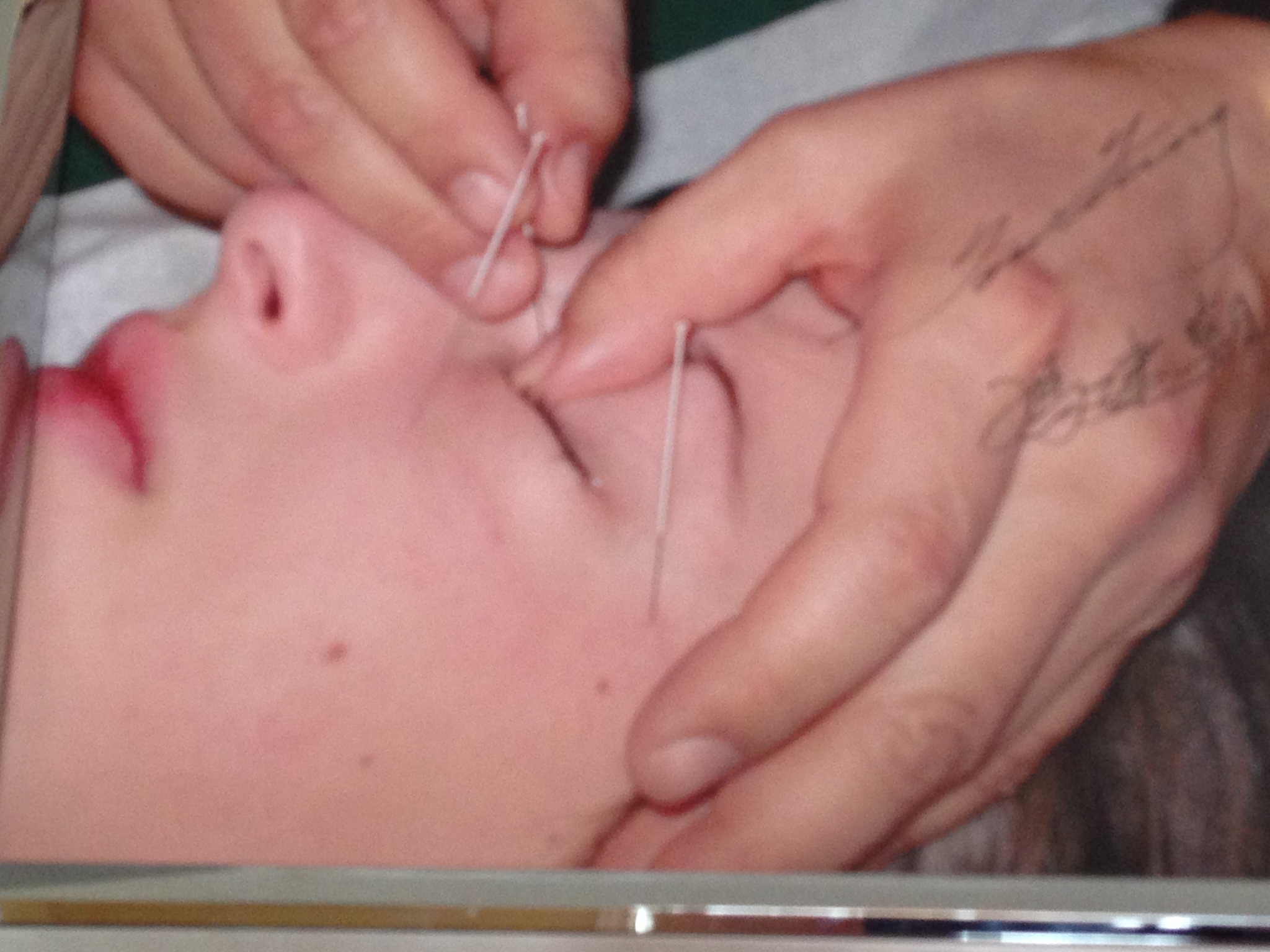 Images Tom Fung Holistic Acupuncture Clinic